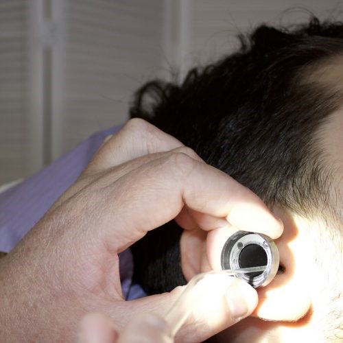 A Guide to Tympanometry Ear Cleaning Clinic