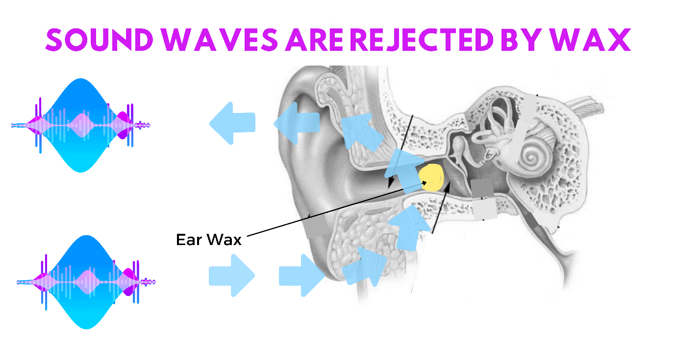 Wax Stuck in Your Hearing Aids? Ear Cleaning Clinic