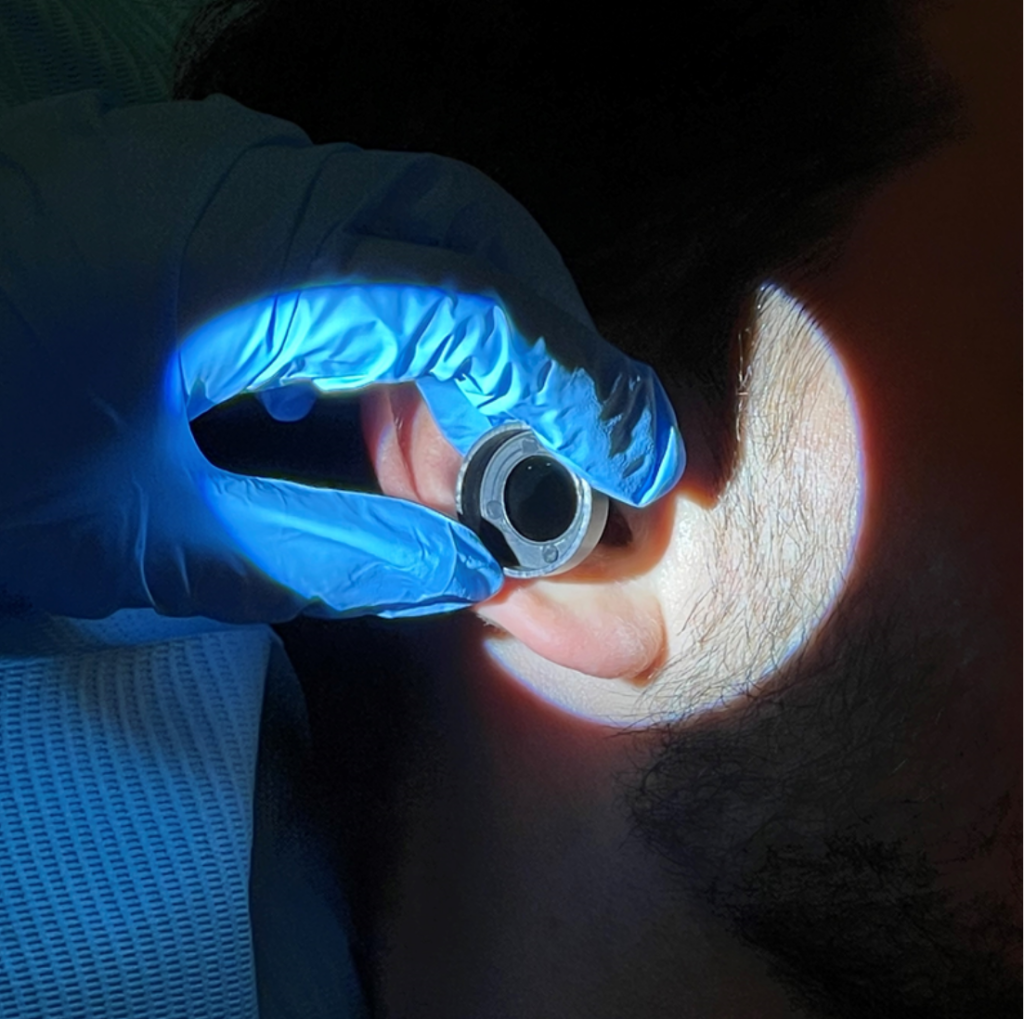 The Importance of Ear Wax Removal During Winter