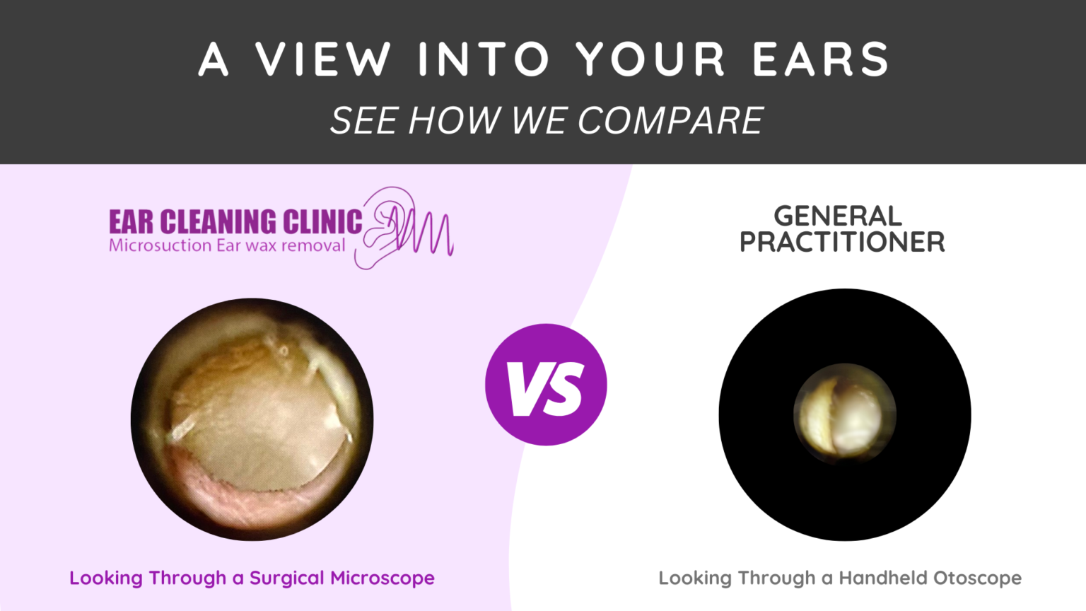 Blocked Hearing Wax Removal & Microsuction Gold Coast Ear Cleaning Clinic